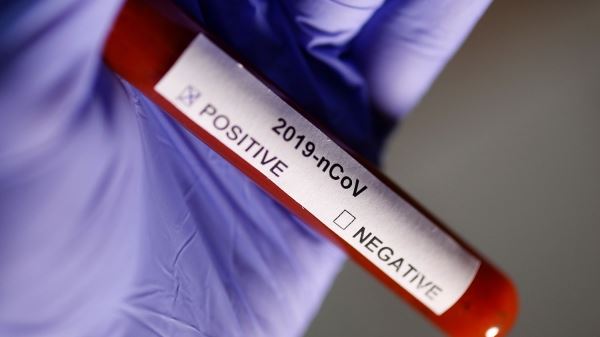 Медики оценили состояние зараженного коронавирусом украинца